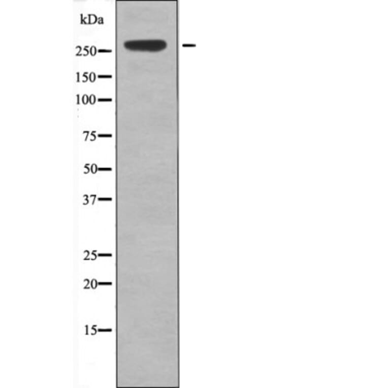 Western blot - IGF2R (Phospho-Ser2484) Antibody from Signalway Antibody (12443) - Antibodies.com