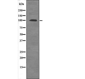 Western blot - FKHRL1 (Phospho-Ser315) Antibody from Signalway Antibody (12475) - Antibodies.com