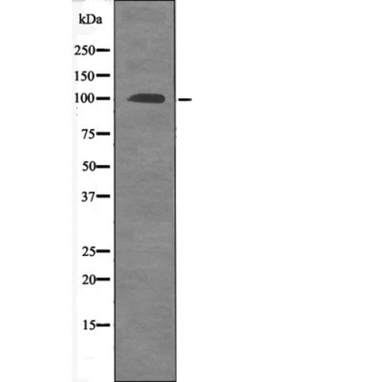 Western blot - FKHRL1 (Phospho-Ser315) Antibody from Signalway Antibody (12475) - Antibodies.com