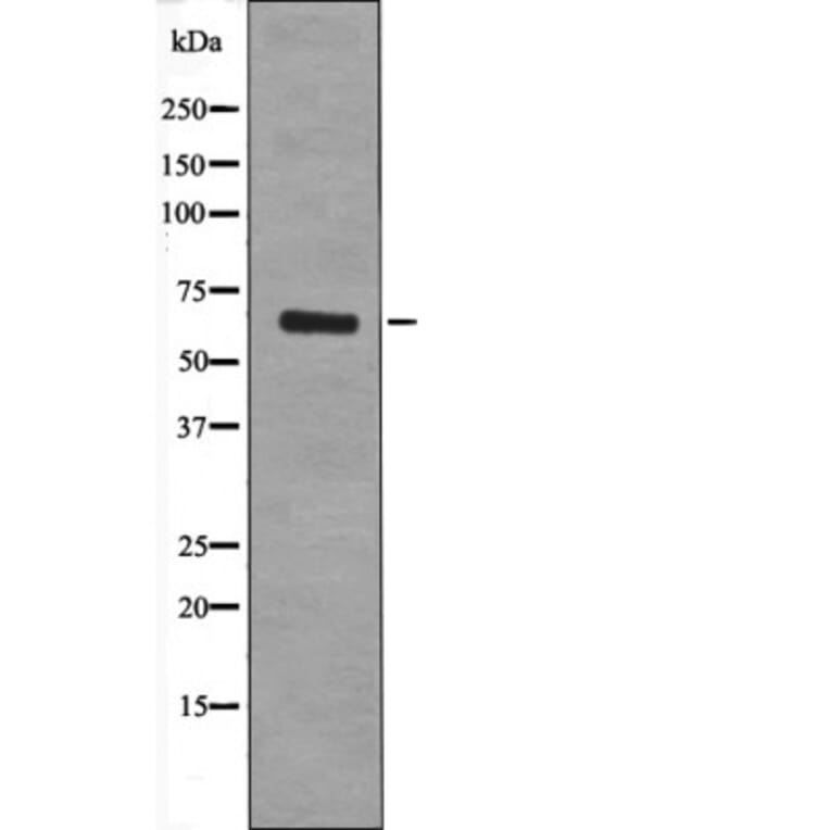 Western blot - TGFBR2 (Phospho-Tyr284) Antibody from Signalway Antibody (12534) - Antibodies.com