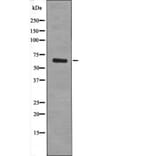 Western blot - TGFBR2 (Phospho-Tyr284) Antibody from Signalway Antibody (12534) - Antibodies.com
