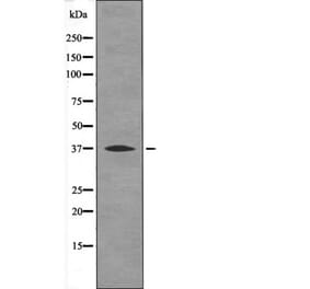 Western blot - BCL-10 (Phospho-Ser138) Antibody from Signalway Antibody (12555) - Antibodies.com