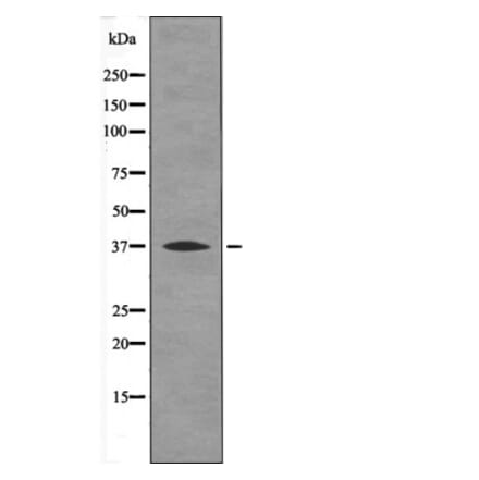 Western blot - BCL-10 (Phospho-Ser138) Antibody from Signalway Antibody (12555) - Antibodies.com