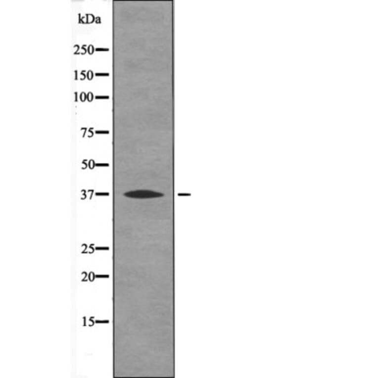 Western blot - BCL-10 (Phospho-Ser138) Antibody from Signalway Antibody (12555) - Antibodies.com