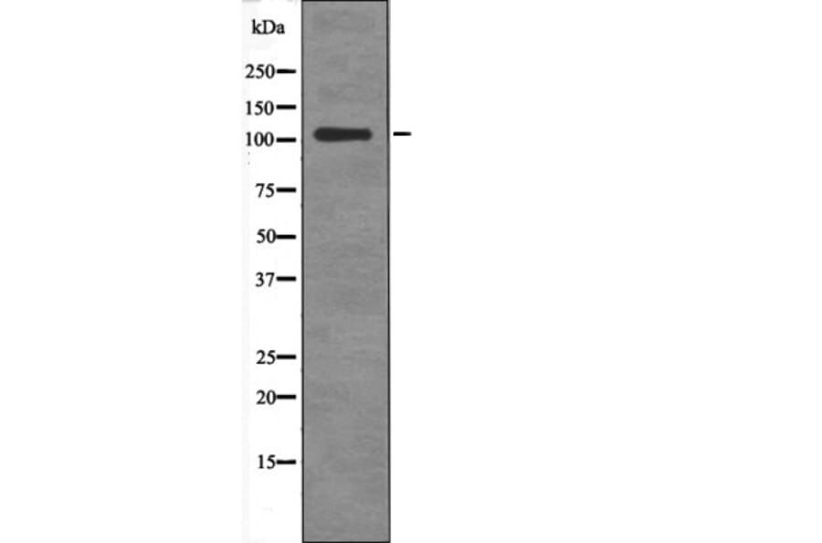 Western blot - BCLAF1 (Phospho-Ser531) Antibody from Signalway Antibody (12577) - Antibodies.com