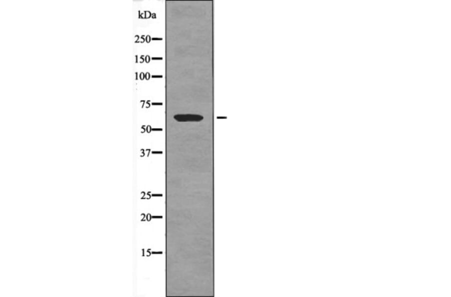 Western blot - CRMP-1 (Phospho-Tyr504) Antibody from Signalway Antibody (12588) - Antibodies.com