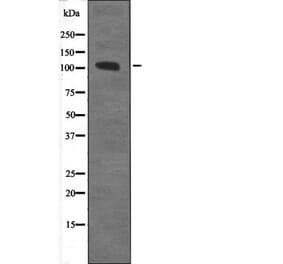 Western blot - CTNND1 (Phospho-Tyr257) Antibody from Signalway Antibody (12590) - Antibodies.com