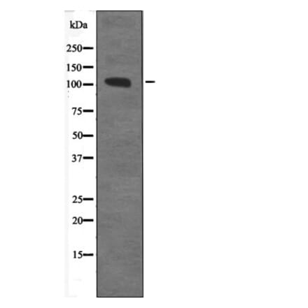 Western blot - CTNND1 (Phospho-Tyr257) Antibody from Signalway Antibody (12590) - Antibodies.com