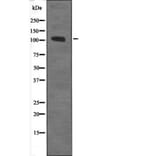 Western blot - CTNND1 (Phospho-Tyr257) Antibody from Signalway Antibody (12590) - Antibodies.com