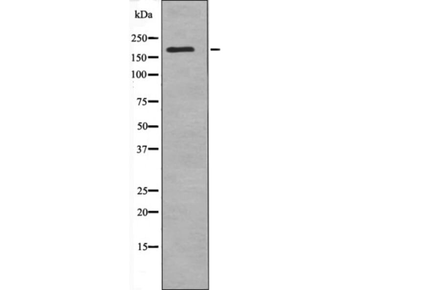 Western blot - CUTL1 (Phospho-Ser1215) Antibody from Signalway Antibody (12592) - Antibodies.com