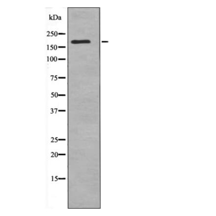 Western blot - CUTL1 (Phospho-Ser1215) Antibody from Signalway Antibody (12592) - Antibodies.com