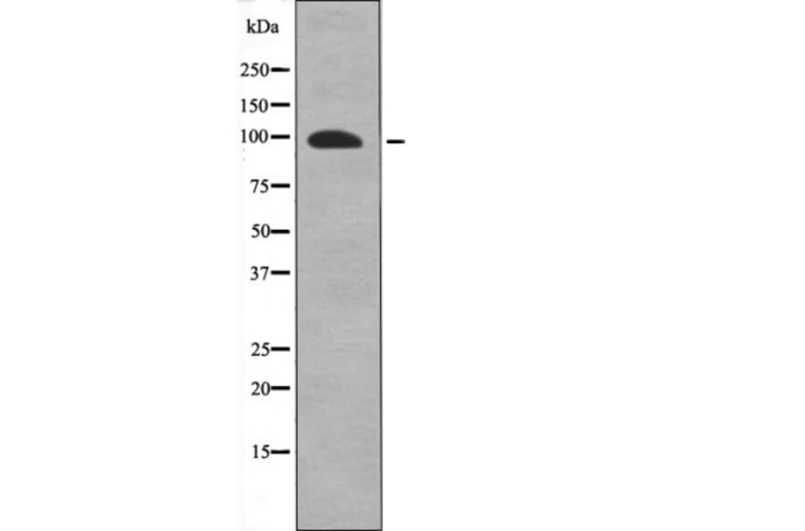 Western blot - FKHRL1 (Phospho-Ser318) Antibody from Signalway Antibody (12601) - Antibodies.com