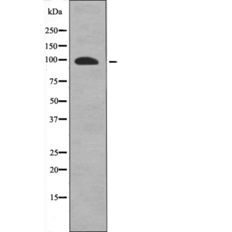 Western blot - FKHRL1 (Phospho-Ser318) Antibody from Signalway Antibody (12601) - Antibodies.com