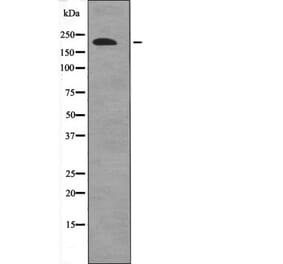 Western blot - 53BP1 (Phospho-Ser1778) Antibody from Signalway Antibody (12657) - Antibodies.com