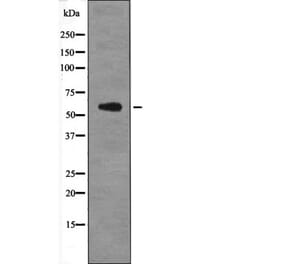 Western blot - PFKFB2 (Phospho-Ser466) Antibody from Signalway Antibody (12663) - Antibodies.com