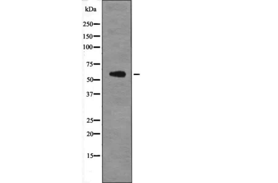 Western blot - PFKFB2 (Phospho-Ser466) Antibody from Signalway Antibody (12663) - Antibodies.com