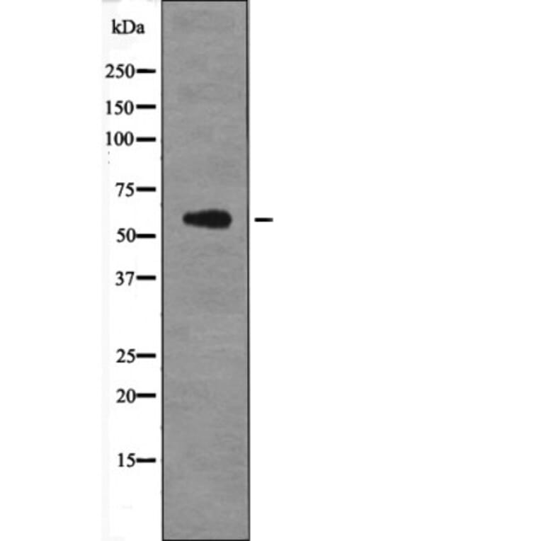 Western blot - PFKFB2 (Phospho-Ser466) Antibody from Signalway Antibody (12663) - Antibodies.com