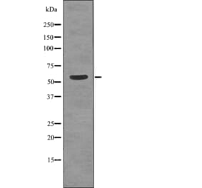 Western blot - TGFBR1 (Phospho-Thr204) Antibody from Signalway Antibody (12737) - Antibodies.com