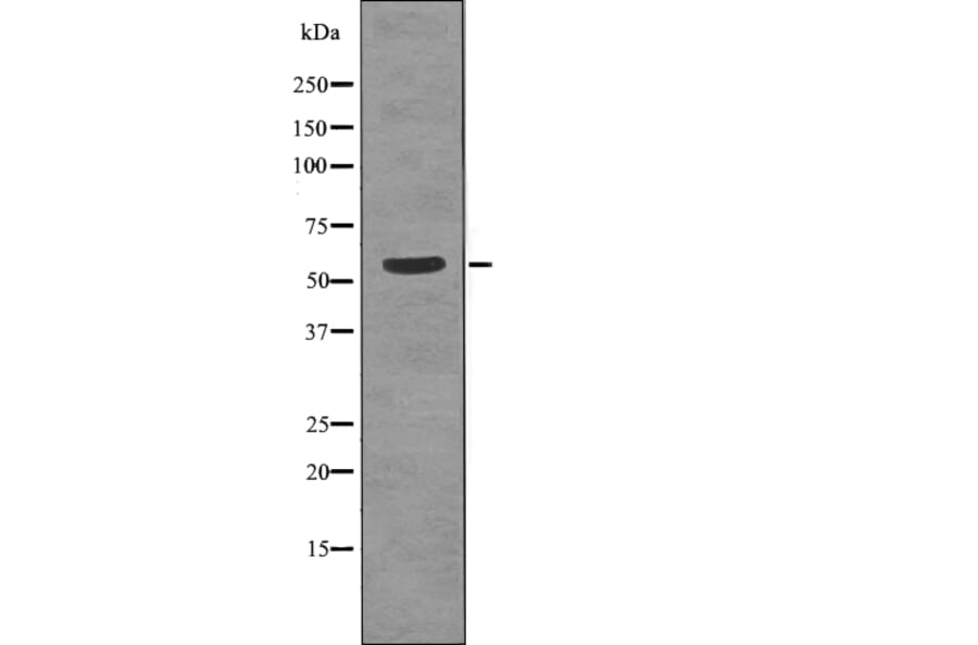 Western blot - TGFBR1 (Phospho-Thr204) Antibody from Signalway Antibody (12737) - Antibodies.com