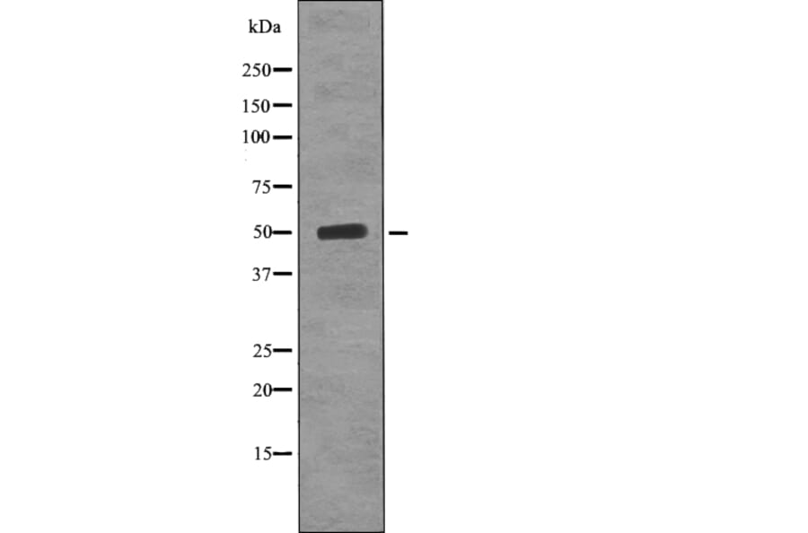 Western blot - AP-2mu (Phospho-Thr156) Antibody from Signalway Antibody (12741) - Antibodies.com