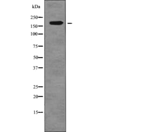 Western blot - FANCD2 (Phospho-Ser717) Antibody from Signalway Antibody (12753) - Antibodies.com