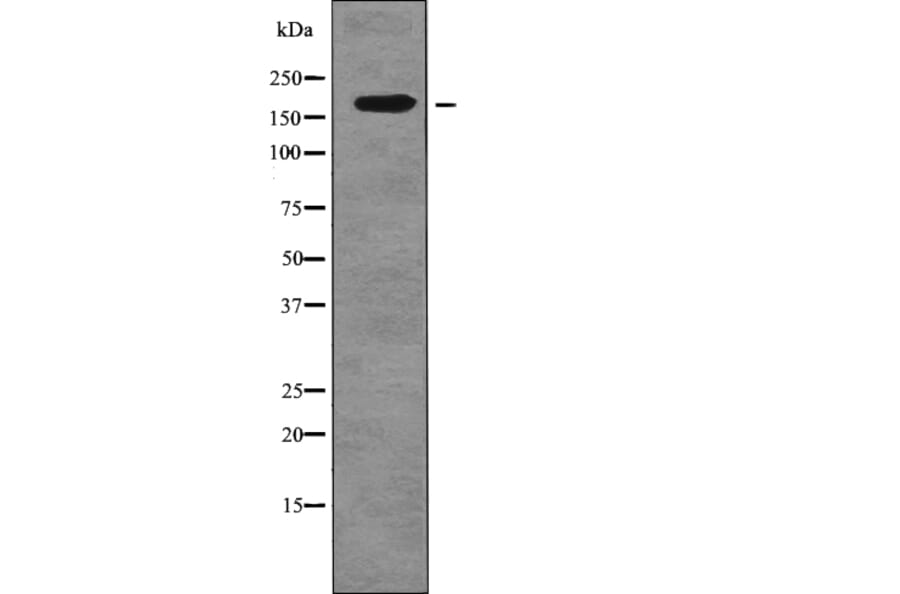 Western blot - FANCD2 (Phospho-Ser717) Antibody from Signalway Antibody (12753) - Antibodies.com