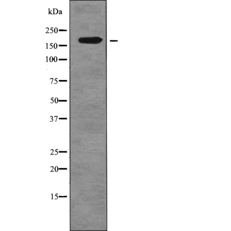 Western blot - FANCD2 (Phospho-Ser717) Antibody from Signalway Antibody (12753) - Antibodies.com