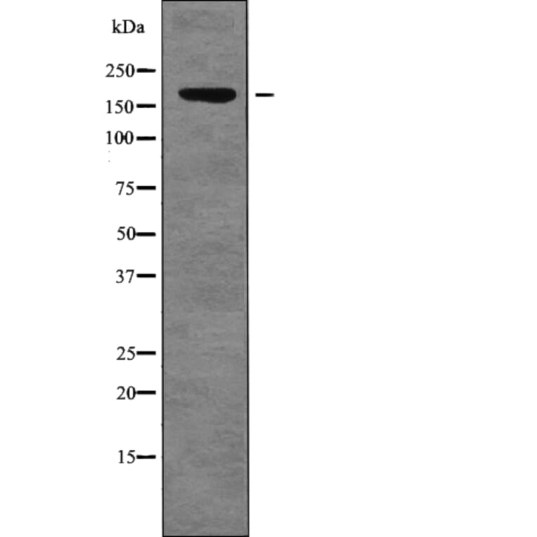 Western blot - FANCD2 (Phospho-Thr691) Antibody from Signalway Antibody (12754) - Antibodies.com