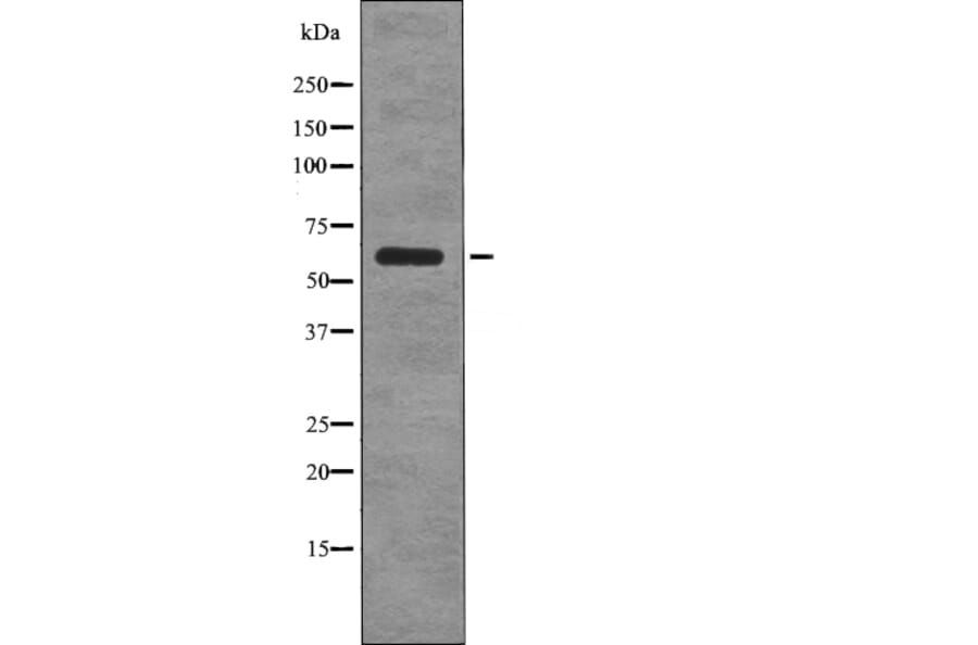 Western blot - G3BP-1 (Phospho-Ser149) Antibody from Signalway Antibody (12756) - Antibodies.com