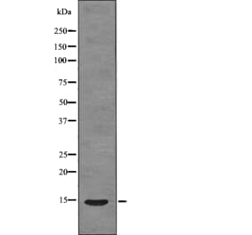 Western blot - S100A9 (Phospho-Thr113) Antibody from Signalway Antibody (12782) - Antibodies.com