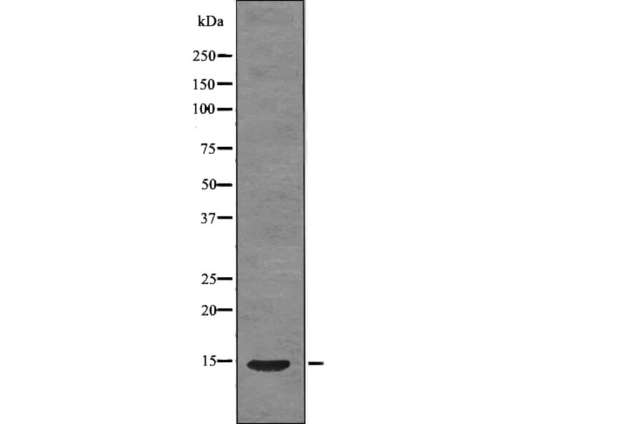 Western blot - S100A9 (Phospho-Thr113) Antibody from Signalway Antibody (12782) - Antibodies.com