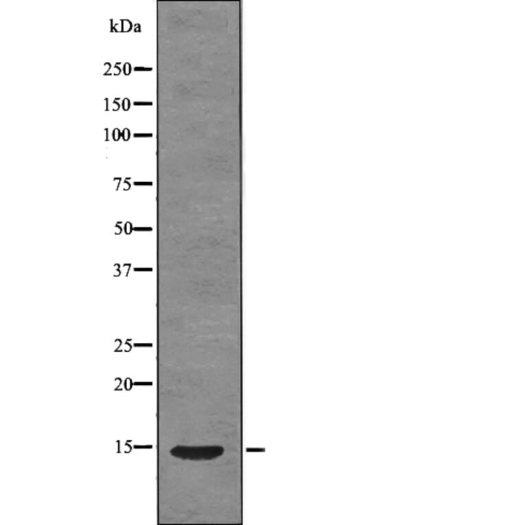 Western blot - S100A9 (Phospho-Thr113) Antibody from Signalway Antibody (12782) - Antibodies.com