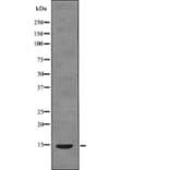 Western blot - S100A9 (Phospho-Thr113) Antibody from Signalway Antibody (12782) - Antibodies.com