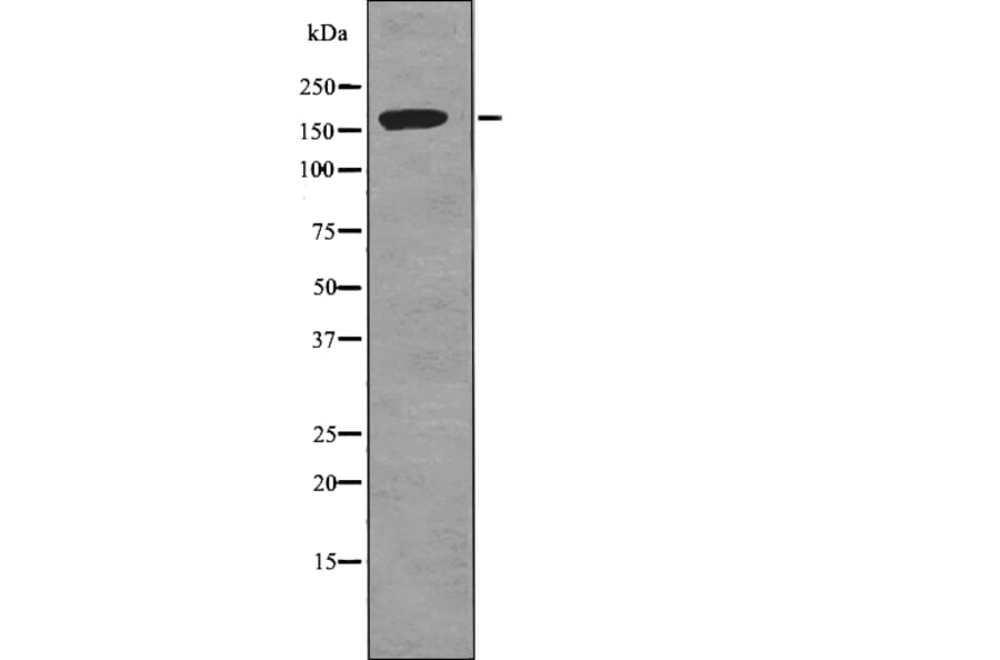 Western blot - TOP2A (Phospho-Ser1337) Antibody from Signalway Antibody (12785) - Antibodies.com