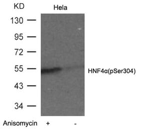 Western blot - HNF4a (Phospho-Ser304) Antibody from Signalway Antibody (11043) - Antibodies.com