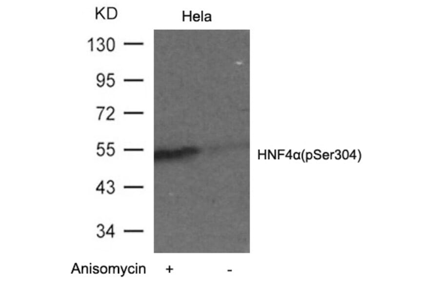 Western blot - HNF4a (Phospho-Ser304) Antibody from Signalway Antibody (11043) - Antibodies.com