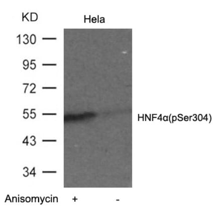 Western blot - HNF4a (Phospho-Ser304) Antibody from Signalway Antibody (11043) - Antibodies.com