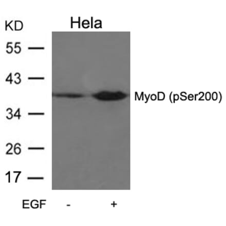 Western blot - MyoD (Phospho-Ser200) Antibody from Signalway Antibody (11077) - Antibodies.com