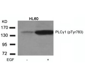 Western blot - PLCgamma1 (Phospho-Tyr783) Antibody from Signalway Antibody (11103) - Antibodies.com