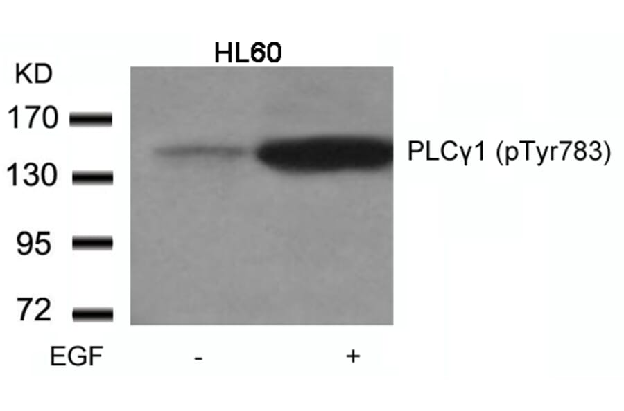 Western blot - PLCgamma1 (Phospho-Tyr783) Antibody from Signalway Antibody (11103) - Antibodies.com
