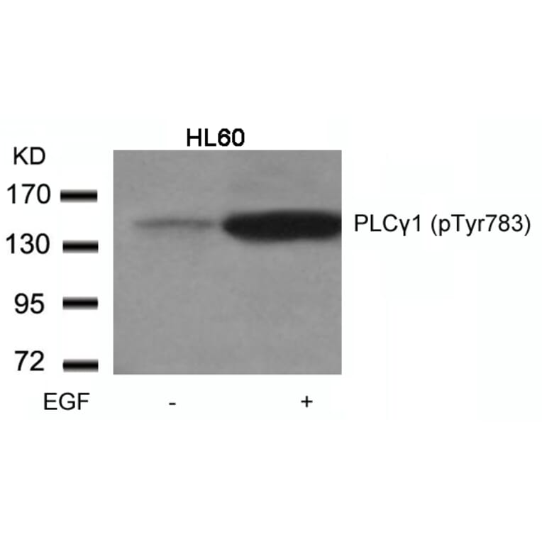 Western blot - PLCgamma1 (Phospho-Tyr783) Antibody from Signalway Antibody (11103) - Antibodies.com