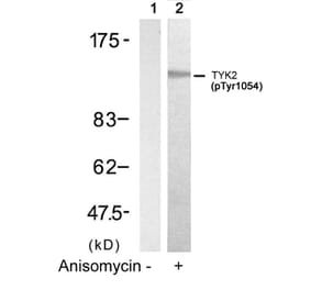 Western blot - TYK2 (Phospho-Tyr1054) Antibody from Signalway Antibody (11148) - Antibodies.com