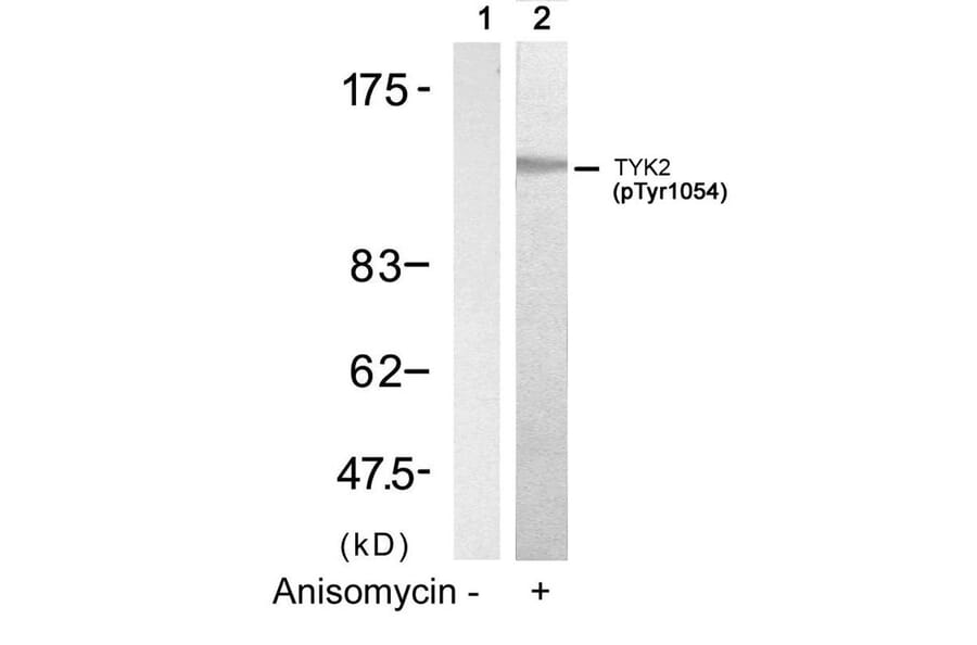 Western blot - TYK2 (Phospho-Tyr1054) Antibody from Signalway Antibody (11148) - Antibodies.com
