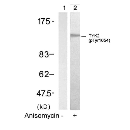 Western blot - TYK2 (Phospho-Tyr1054) Antibody from Signalway Antibody (11148) - Antibodies.com