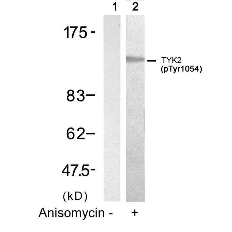 Western blot - TYK2 (Phospho-Tyr1054) Antibody from Signalway Antibody (11148) - Antibodies.com