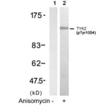Western blot - TYK2 (Phospho-Tyr1054) Antibody from Signalway Antibody (11148) - Antibodies.com