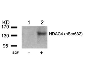 Western blot - HDAC4 (Phospho-Ser632) Antibody from Signalway Antibody (11192) - Antibodies.com