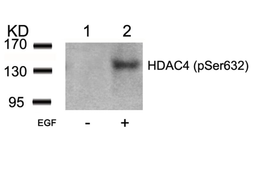 Western blot - HDAC4 (Phospho-Ser632) Antibody from Signalway Antibody (11192) - Antibodies.com