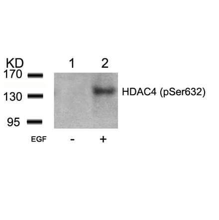 Western blot - HDAC4 (Phospho-Ser632) Antibody from Signalway Antibody (11192) - Antibodies.com