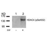 Western blot - HDAC4 (Phospho-Ser632) Antibody from Signalway Antibody (11192) - Antibodies.com
